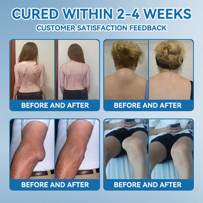 🔥𝐅𝐃𝐀 𝐀𝐩𝐩𝐫𝐨𝐯𝐞𝐝👩‍⚕️|𝒁𝐯𝐨𝐞𝐯𝐨® 𝑩𝐏𝐂-𝟏𝟓𝟕 𝐉𝐨𝐢𝐧𝐭 𝐇𝐞𝐚𝐥𝐢𝐧𝐠 𝐂𝐫𝐞𝐚𝐦🦴 Relief for Arthritis, Neuropathy, Rheumatism & Sports Injuries & 𝐌𝐨𝐫𝐞