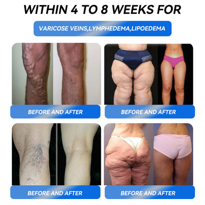 ☀️Ourlyard® GLP-1 Pro Weight Loss Oral Solution – Visible results in 7 days, no side effects, suitable for all age groups