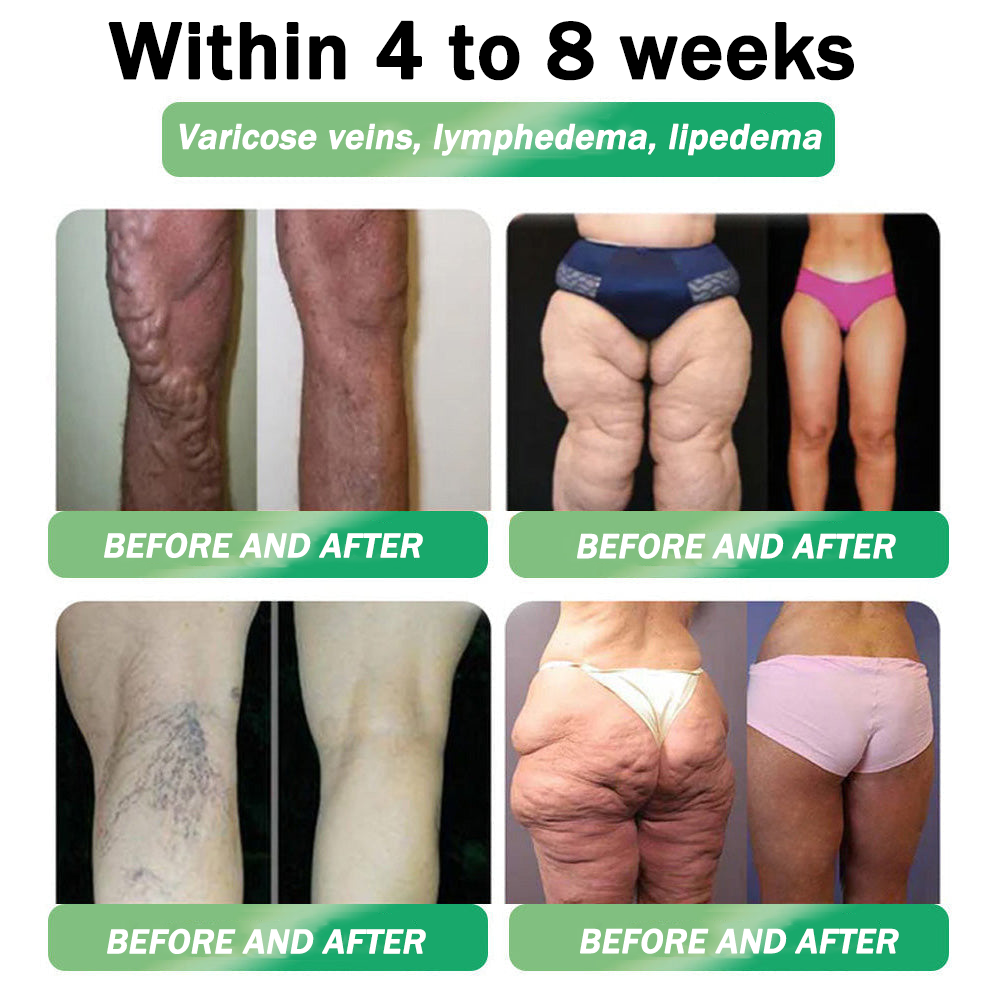 🧡Enjoy 30% OFF for adding the second one🧡