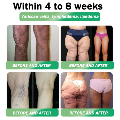 🧡Enjoy 30% OFF for adding the second one🧡