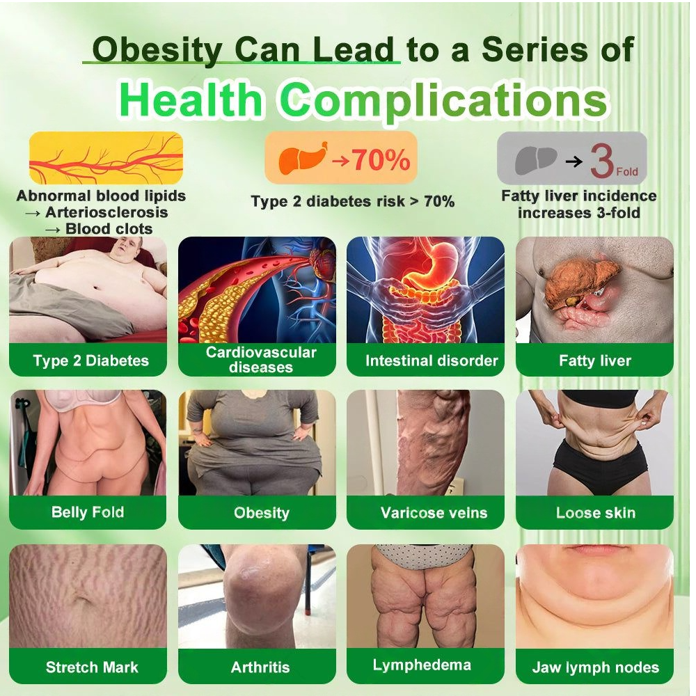 👑Enjoy 30% OFF for adding the second one