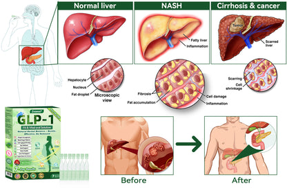 🧡Enjoy 30% OFF for adding the second one🧡