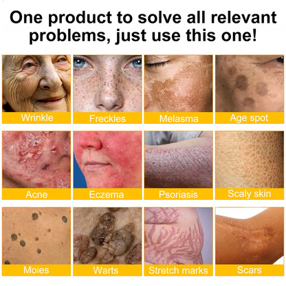 🔥FDA Approved: Ourlyard® Bee Venom Skin Restoration Cream — 🔥Limited Time 80% OFF🔥