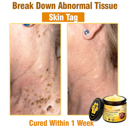 🔥FDA Approved: Ourlyard® Bee Venom Skin Restoration Cream — 🔥Limited Time 80% OFF🔥