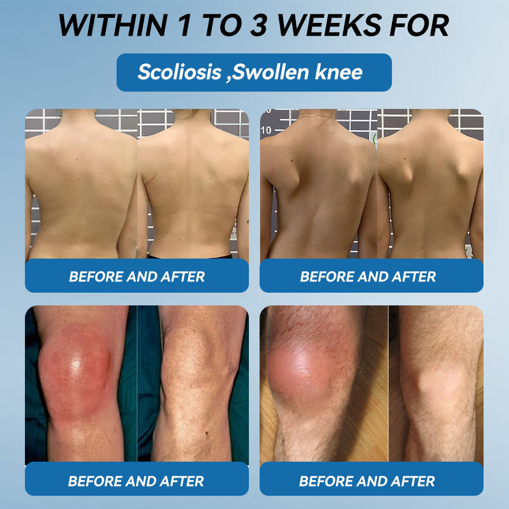 🔥𝐅𝐃𝐀 𝐀𝐩𝐩𝐫𝐨𝐯𝐞𝐝👩‍⚕️|𝒁𝐯𝐨𝐞𝐯𝐨® 𝑩𝐏𝐂-𝟏𝟓𝟕 𝐉𝐨𝐢𝐧𝐭 𝐇𝐞𝐚𝐥𝐢𝐧𝐠 𝐂𝐫𝐞𝐚𝐦🦴 Relief for Arthritis, Neuropathy, Rheumatism & Sports Injuries & 𝐌𝐨𝐫𝐞