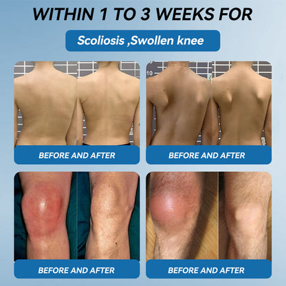 🔥𝐅𝐃𝐀 𝐀𝐩𝐩𝐫𝐨𝐯𝐞𝐝👩‍⚕️|𝒁𝐯𝐨𝐞𝐯𝐨® 𝑩𝐏𝐂-𝟏𝟓𝟕 𝐉𝐨𝐢𝐧𝐭 𝐇𝐞𝐚𝐥𝐢𝐧𝐠 𝐂𝐫𝐞𝐚𝐦🦴 Relief for Arthritis, Neuropathy, Rheumatism & Sports Injuries & 𝐌𝐨𝐫𝐞