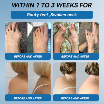 🔥𝐅𝐃𝐀 𝐀𝐩𝐩𝐫𝐨𝐯𝐞𝐝👩‍⚕️|𝒁𝐯𝐨𝐞𝐯𝐨® 𝑩𝐏𝐂-𝟏𝟓𝟕 𝐉𝐨𝐢𝐧𝐭 𝐇𝐞𝐚𝐥𝐢𝐧𝐠 𝐂𝐫𝐞𝐚𝐦🦴 Relief for Arthritis, Neuropathy, Rheumatism & Sports Injuries & 𝐌𝐨𝐫𝐞