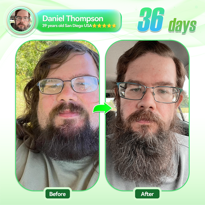 🧡Enjoy 30% OFF for adding the second one🧡