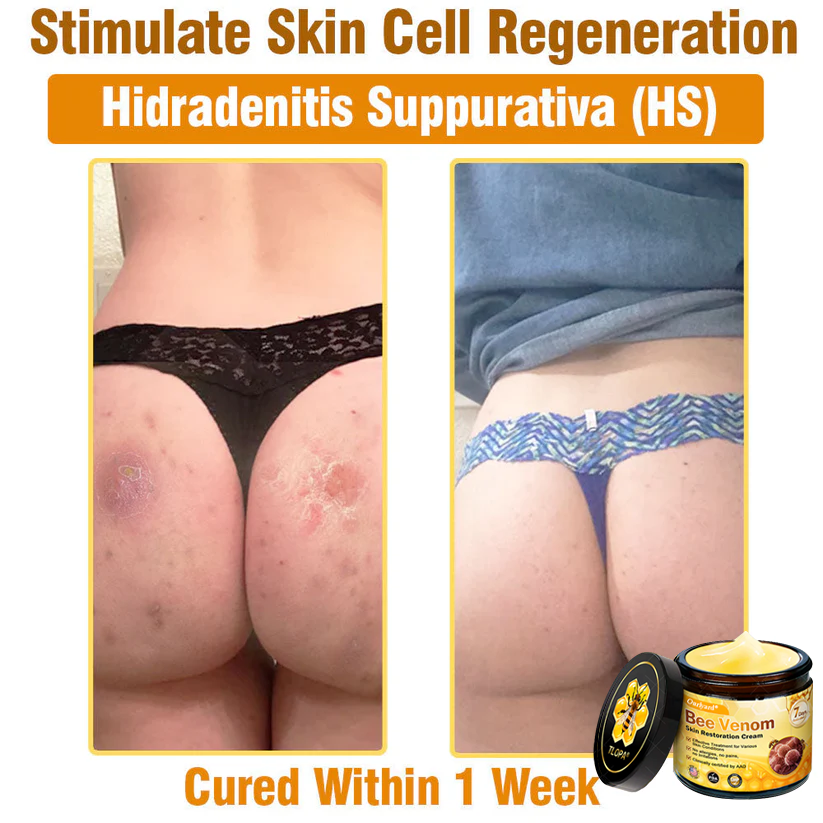 🔥FDA Approved: Ourlyard® Bee Venom Skin Restoration Cream — 🔥Limited Time 80% OFF🔥