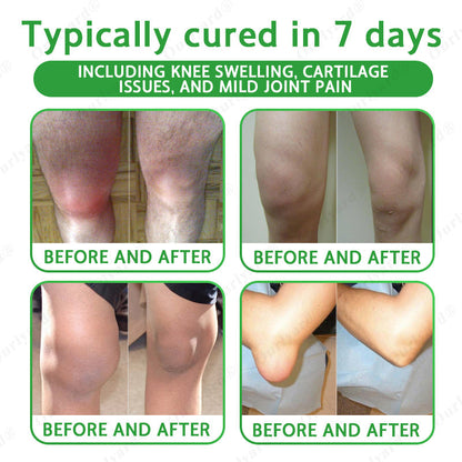 🔥🔥FDA Approved|Ourlyard® Advanced Magnesium & Emu Oil Massage Pain Relief Cream (🏅The Ultimate Solution for Muscle Aches, Arthritis, Joint Pain, Nerve Pain, Inflammation, and Stiffness)