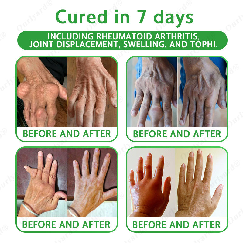 🔥🔥FDA Approved|Ourlyard® Advanced Magnesium & Emu Oil Massage Pain Relief Cream (🏅The Ultimate Solution for Muscle Aches, Arthritis, Joint Pain, Nerve Pain, Inflammation, and Stiffness)