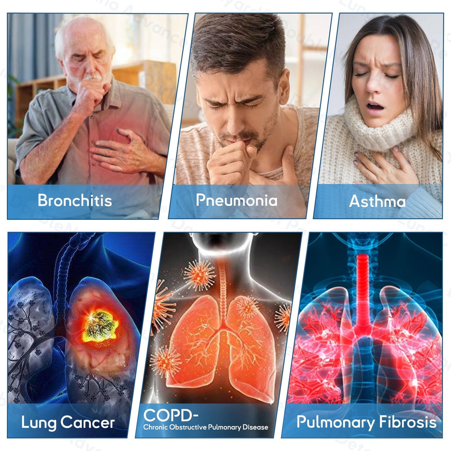 🛡️🛡️FDA Approved|Zvoevo® DoubleNano COPD Relief Patch (💝 Cough, wheezing, shortness of breath, sputum, stuffy nose, bronchitis, bronchitis, allergy symptoms, lung discomfort🫁)