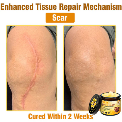 🔥FDA Approved: Ourlyard® Bee Venom Skin Restoration Cream — 🔥Limited Time 80% OFF🔥